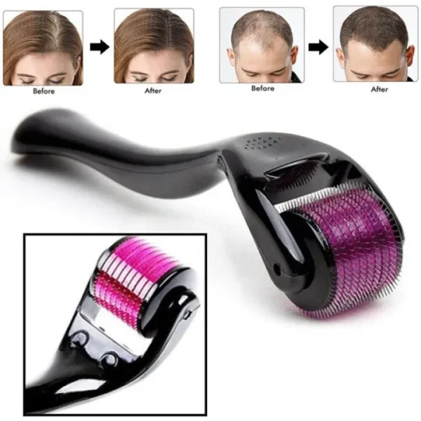 derma roller 0.5mm for hair & skin therapy | 540 titanium micro needles derma roller 0.5mm for hair & skin therapy | 540 titanium micro needles